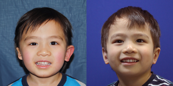 COLIN_B&A_AP